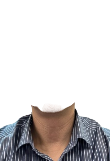 배땅떱 어깨